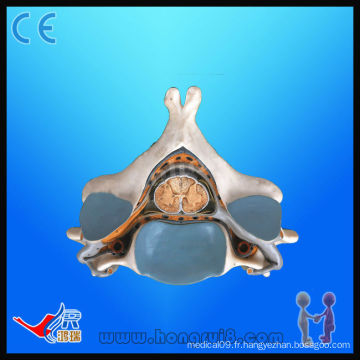 Modèle anatomique - Cinquième vertébrale cervicale avec moelle épinière et nerf